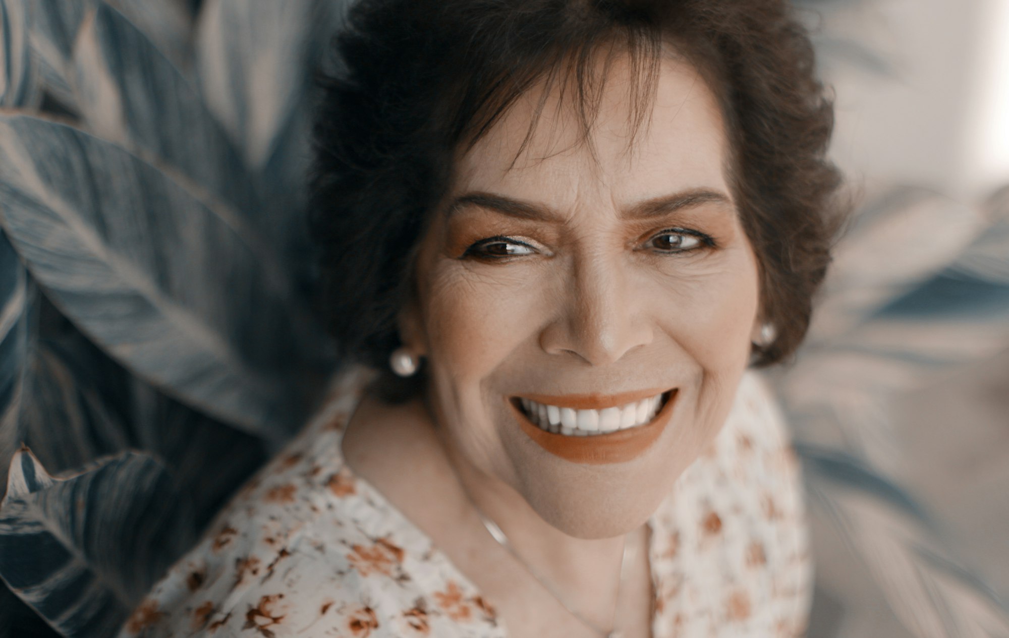 Eyelid Reduction Surgery (Blepharoplasty)